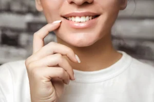 Does Teeth Whitening Damage Your Teeth