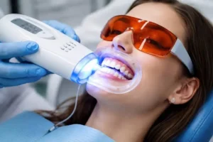 Is Laser Teeth Whitening Permanent